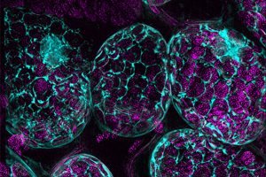 Plant_Mesophyll_Cells_with-Chloroplasts