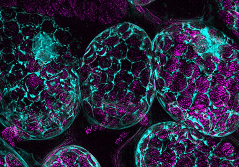 Plant_Mesophyll_Cells_with-Chloroplasts